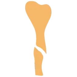 Complex Fracture Injuries